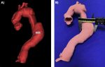 Quality Assurance of 3D Printed Anatomic Models