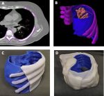 3D Printing in Nuclear Medicine and Radiation Therapy