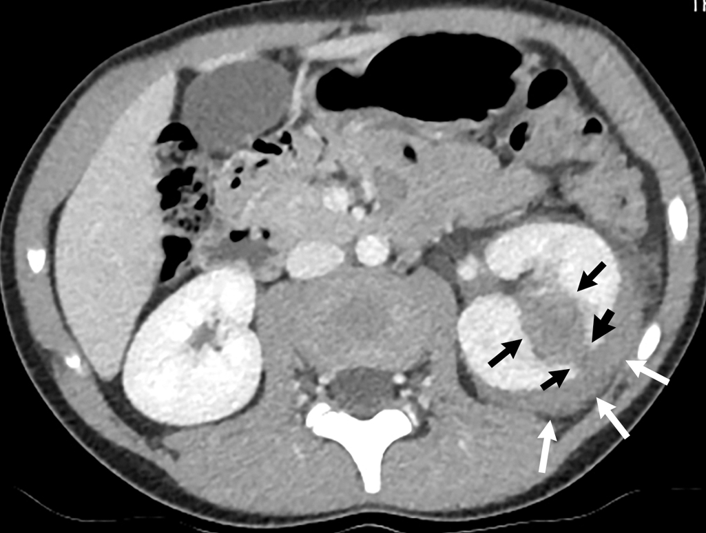 Buckle up: Abdominal trauma | Radiology Key