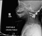 Check that neck: Cervical spine imaging