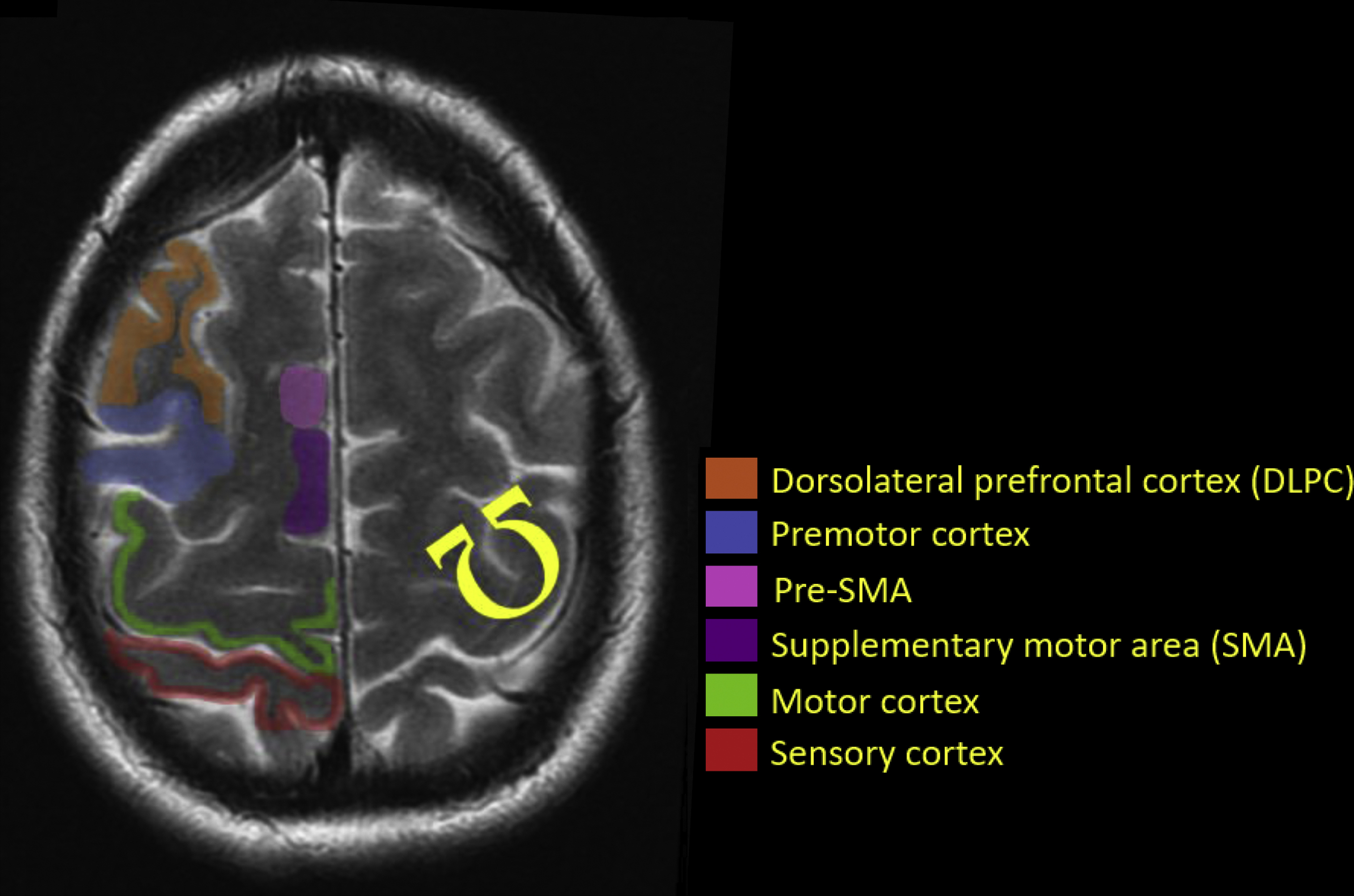Mri Anatomy Brain Axial Image 14 Brain Anatomy Radiol - vrogue.co