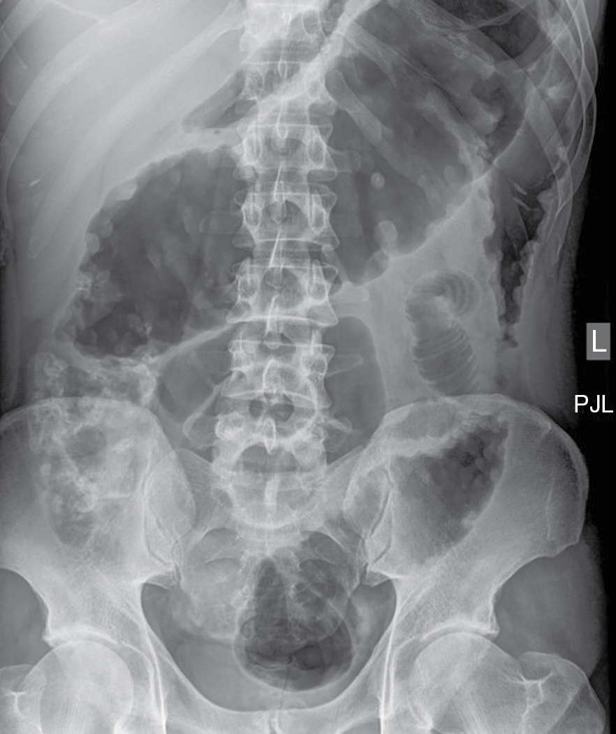 abdominal x ray case study