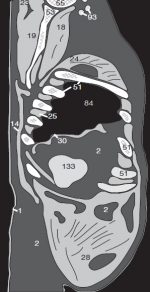 Anatomy in Sagittal MPRs