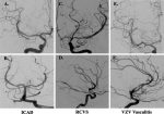 Imaging Approaches and Challenges in the Assessment of the Intracranial Vasculature