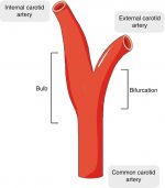 of the Carotid Artery