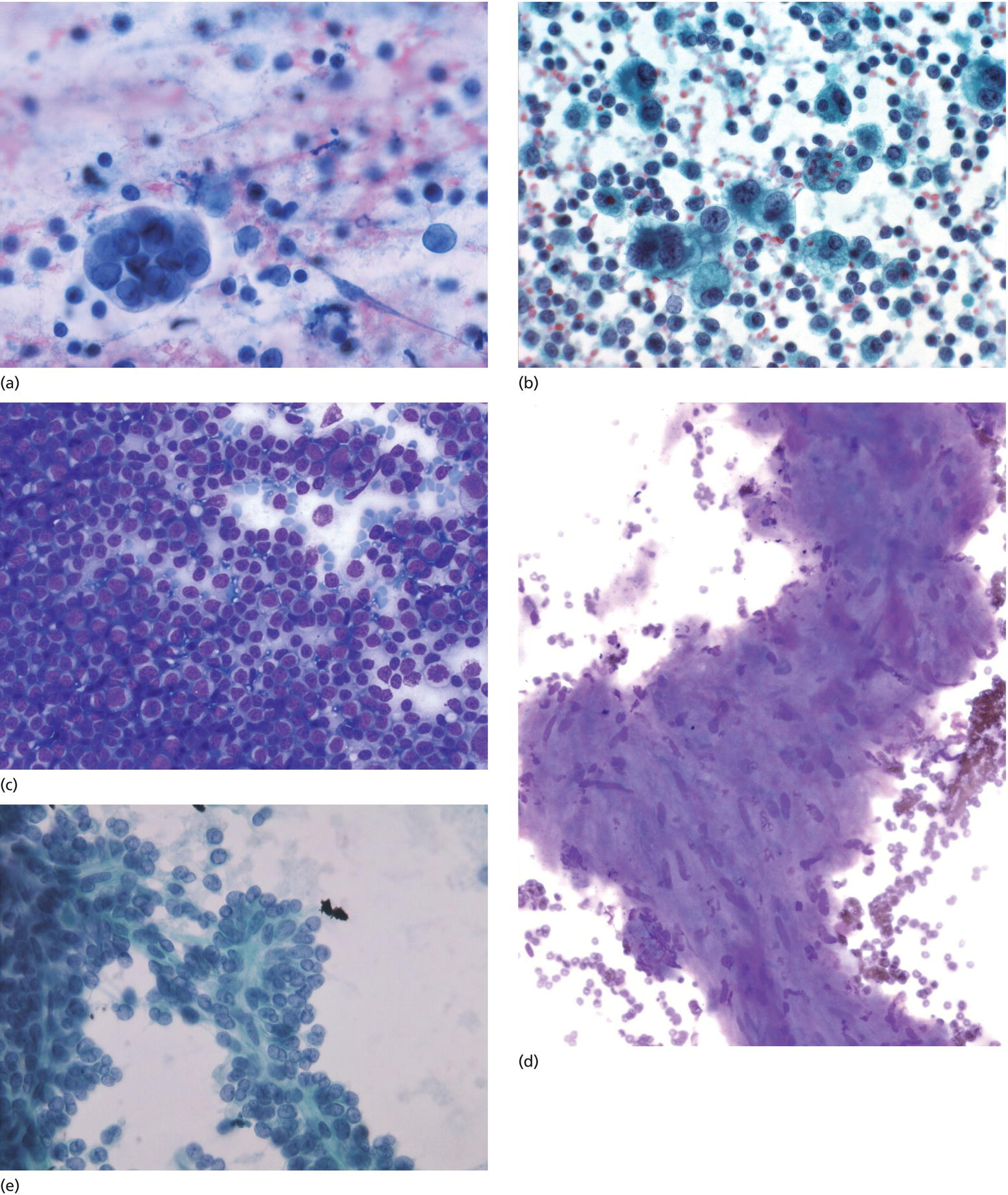 How to Interpret EUS‐FNA Cytology Radiology Key