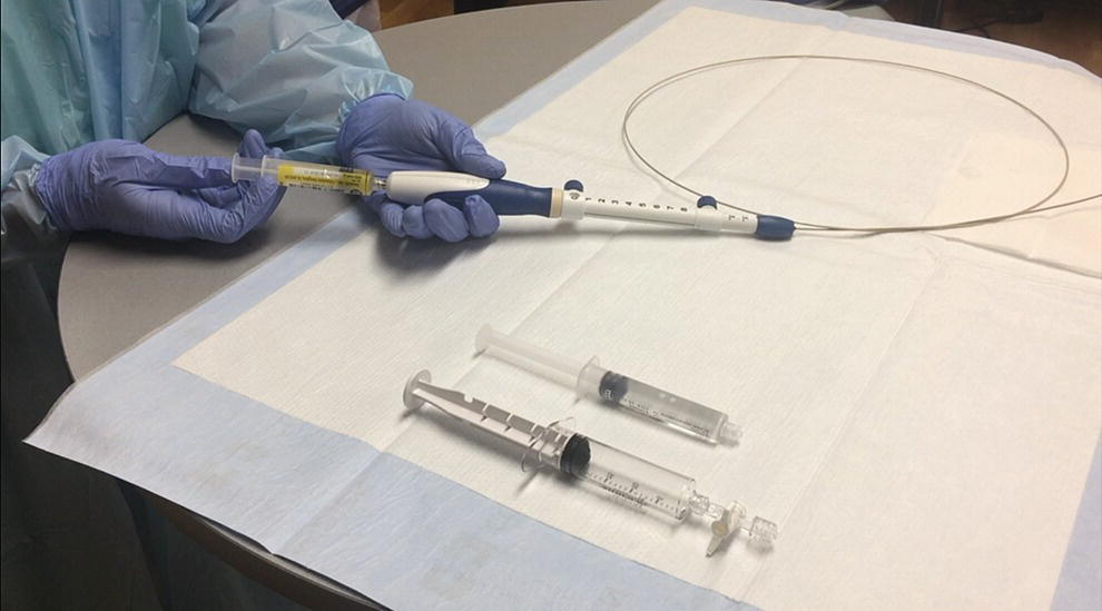 Photo depicts priming the needle with heparin for wet suction technique.