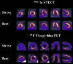Novel Tracers and Radionuclides in PET Imaging