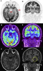 Clinical Applications of PET/MR Imaging