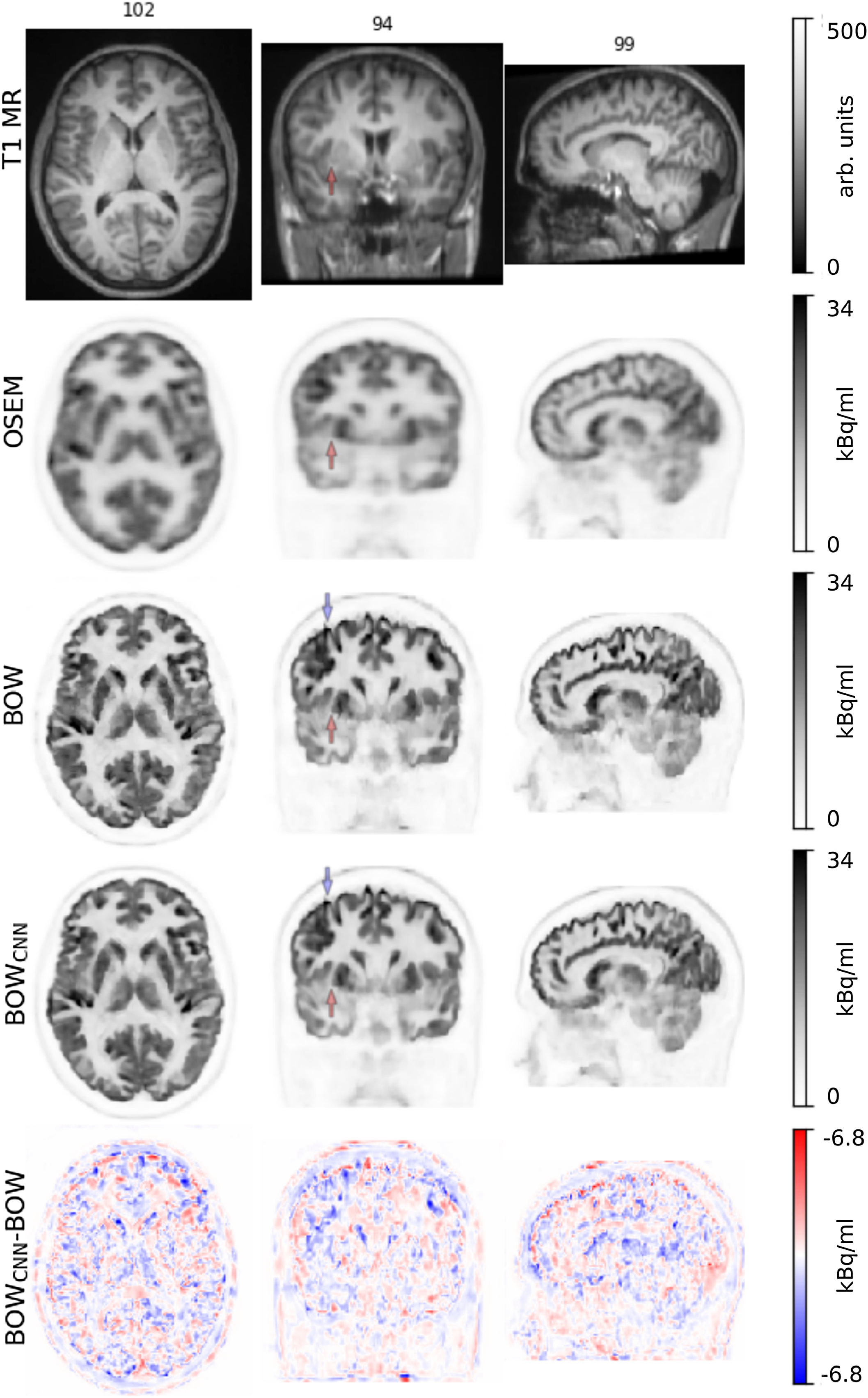 PET/MRI: Technical And Methodological Aspects | Radiology Key