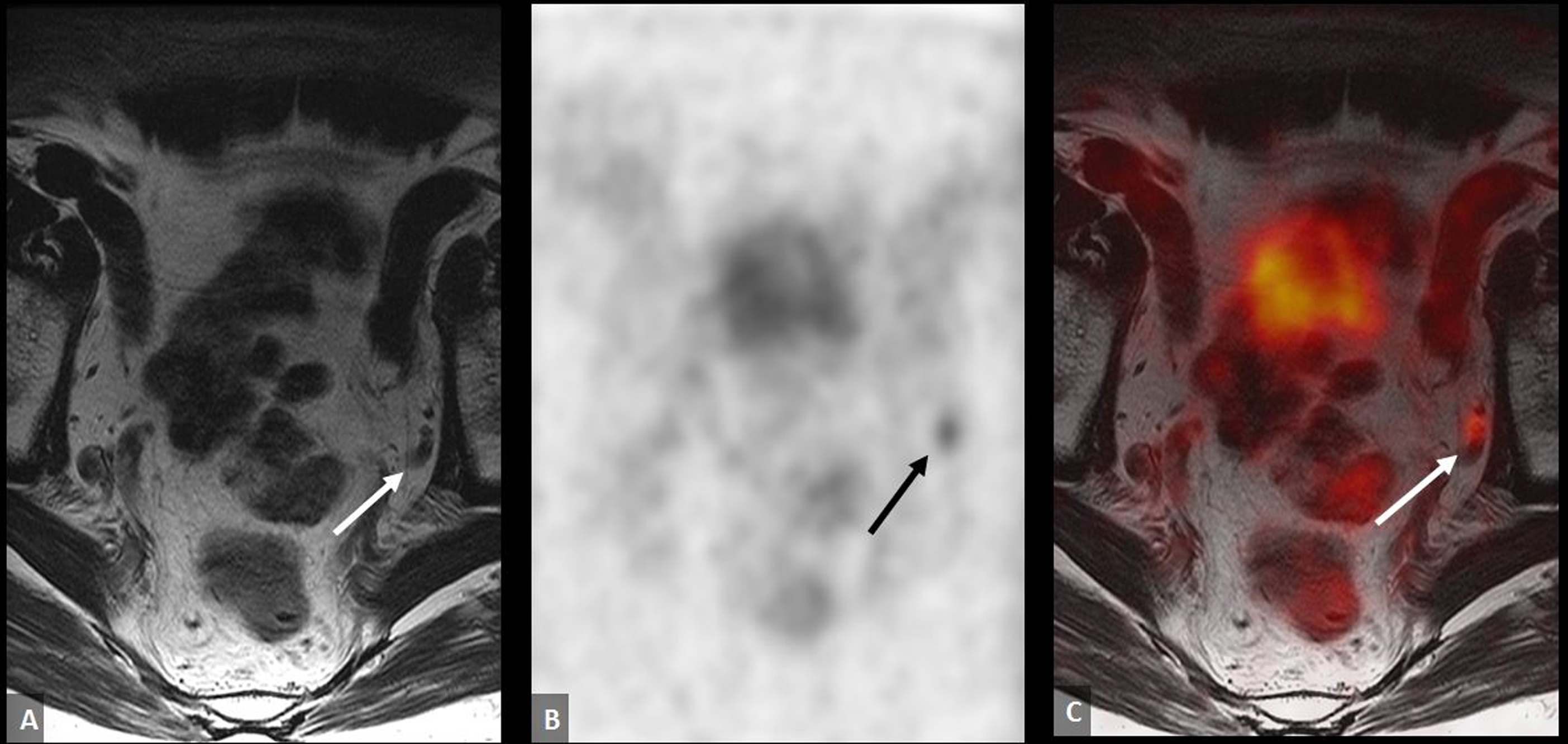 genitourinary-imaging-radiology-key