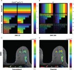 Diffusion-Weighted Imaging (DWI) for Breast Lesion Characterization: The Olea Medical Perspective and the Utilization of Olea Sphere Software