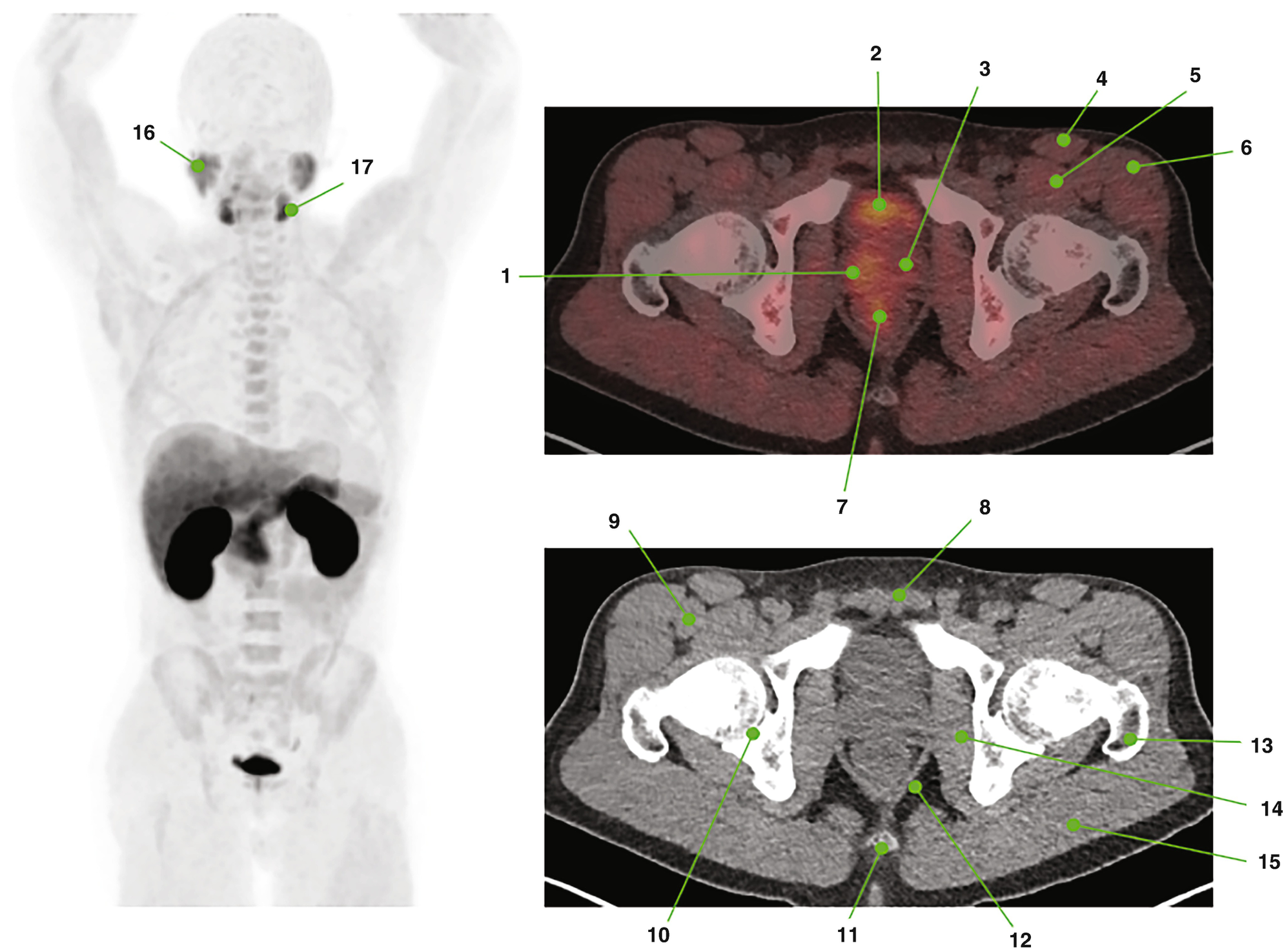 and-anatomy-of-pet-ct-radiology-key