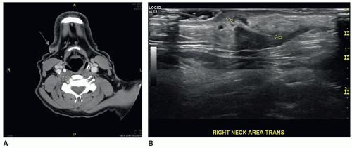 Foreign Bodies Radiology Key 8687