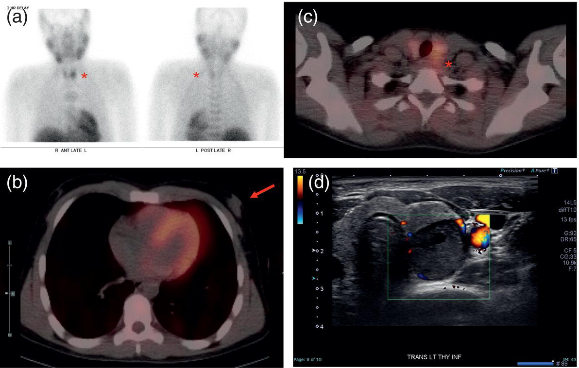 A Correlative Approach To Breast Imaging Radiology Key 5473