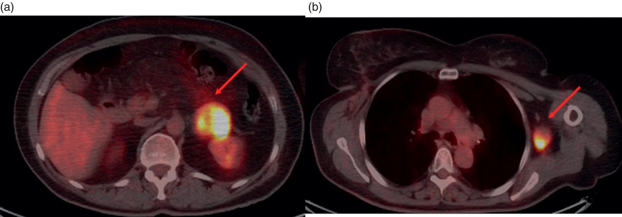 Correlative Imaging in Endocrine Diseases | Radiology Key