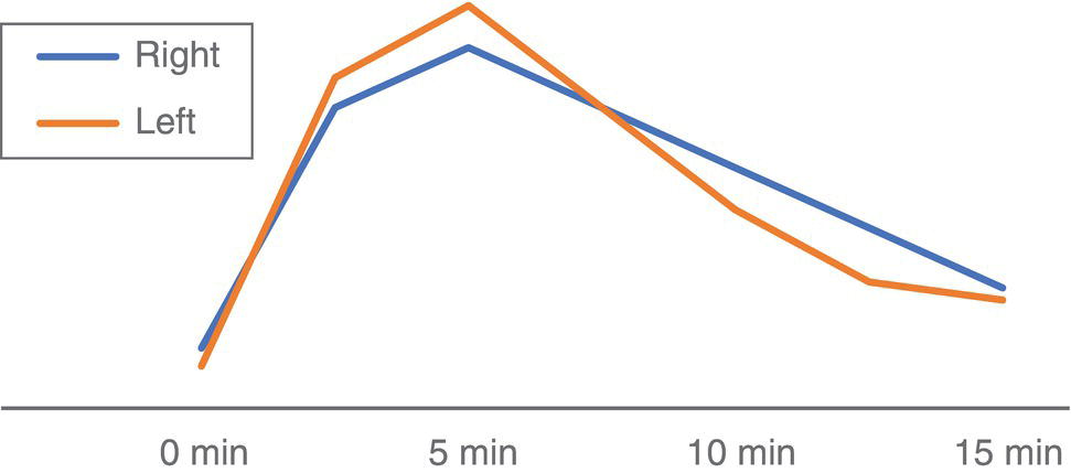 Schematic illustration of normal renogram.