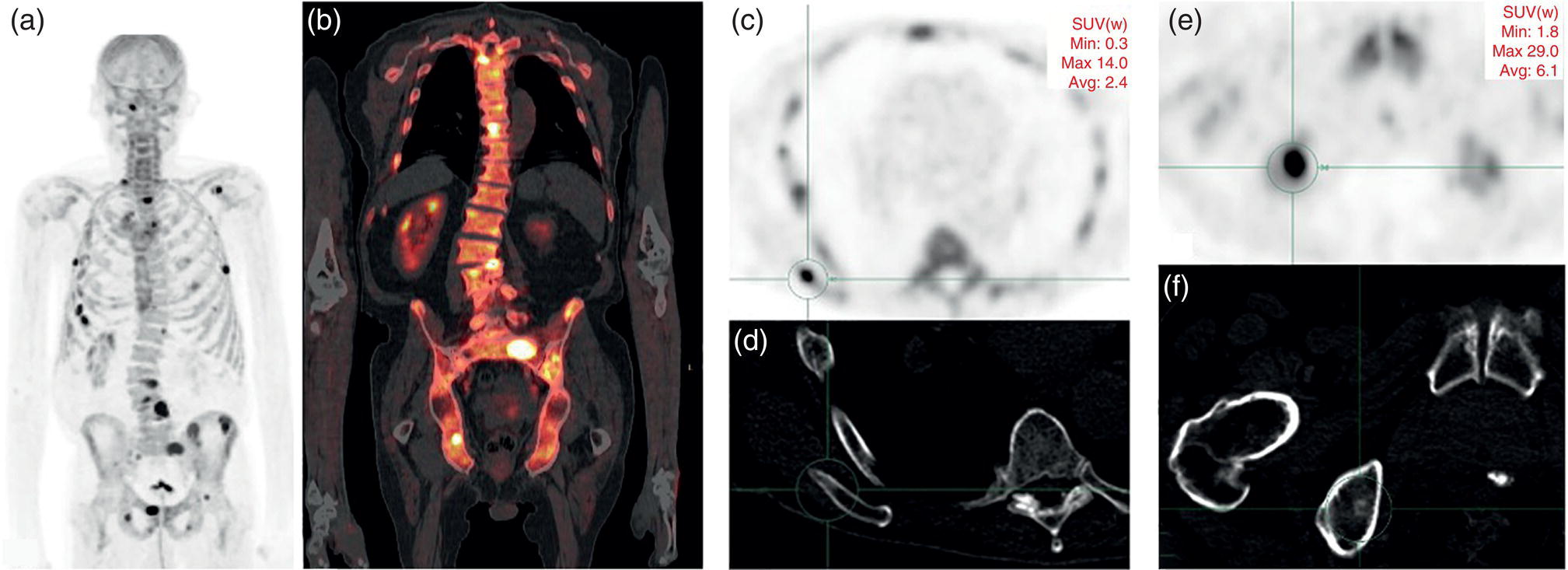 Correlative Approach To Prostate Imaging Radiology Key