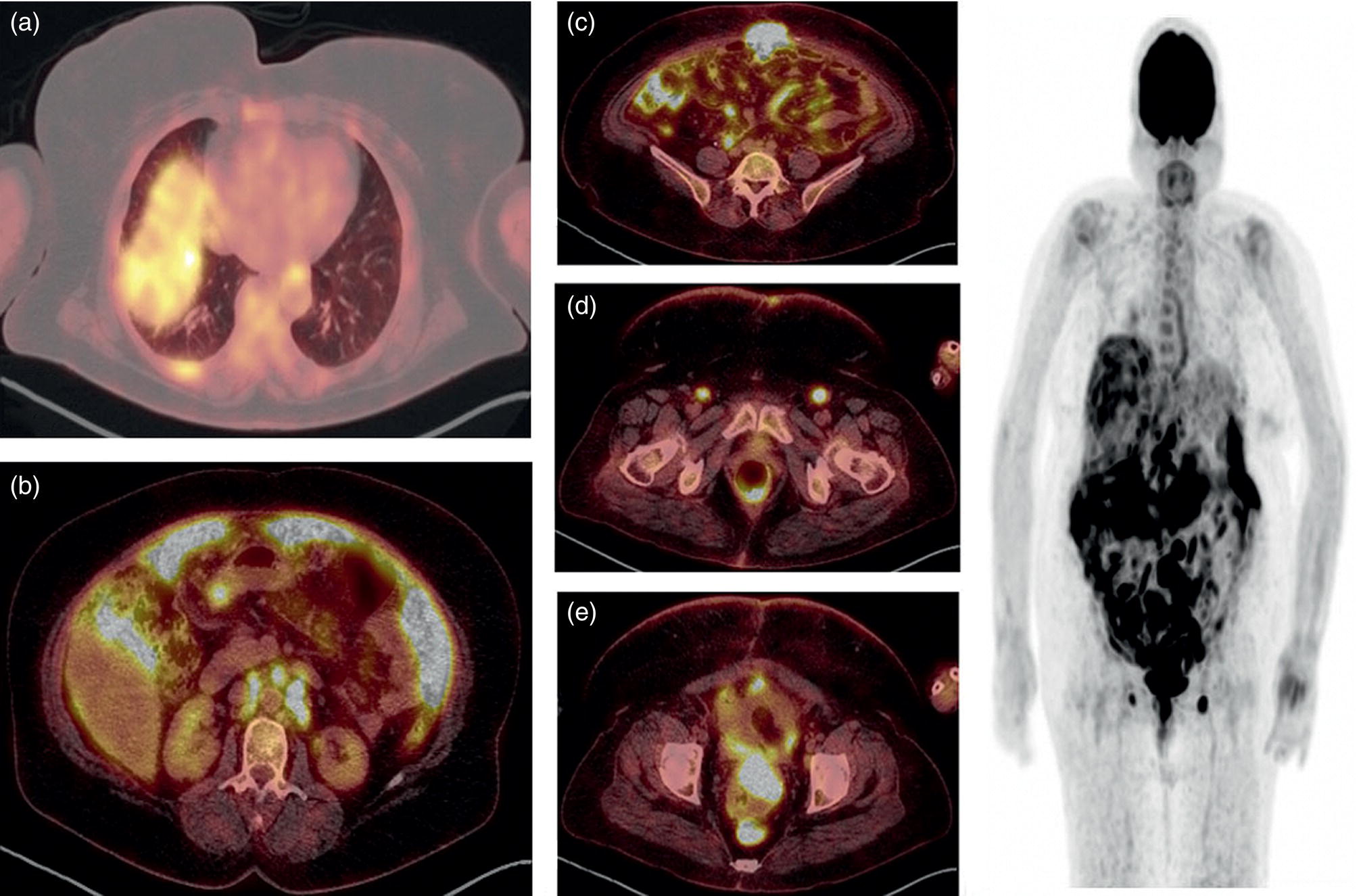 Correlative Imaging Of The Female Reproductive System Radiology Key 