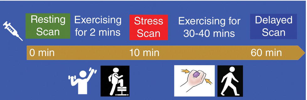 A table records the pending scan, exercising for 2 minutes, stress scan, exercising for 30 minutes, and delayed scan details.