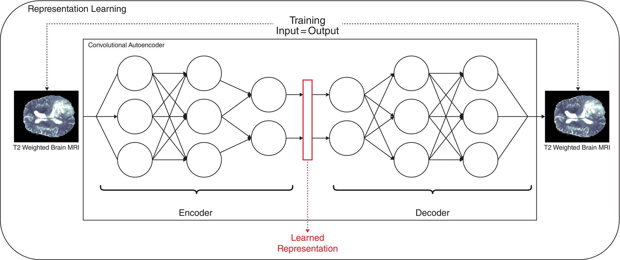 Schematic illustration of an overview of how deep learning exploits representation learning.