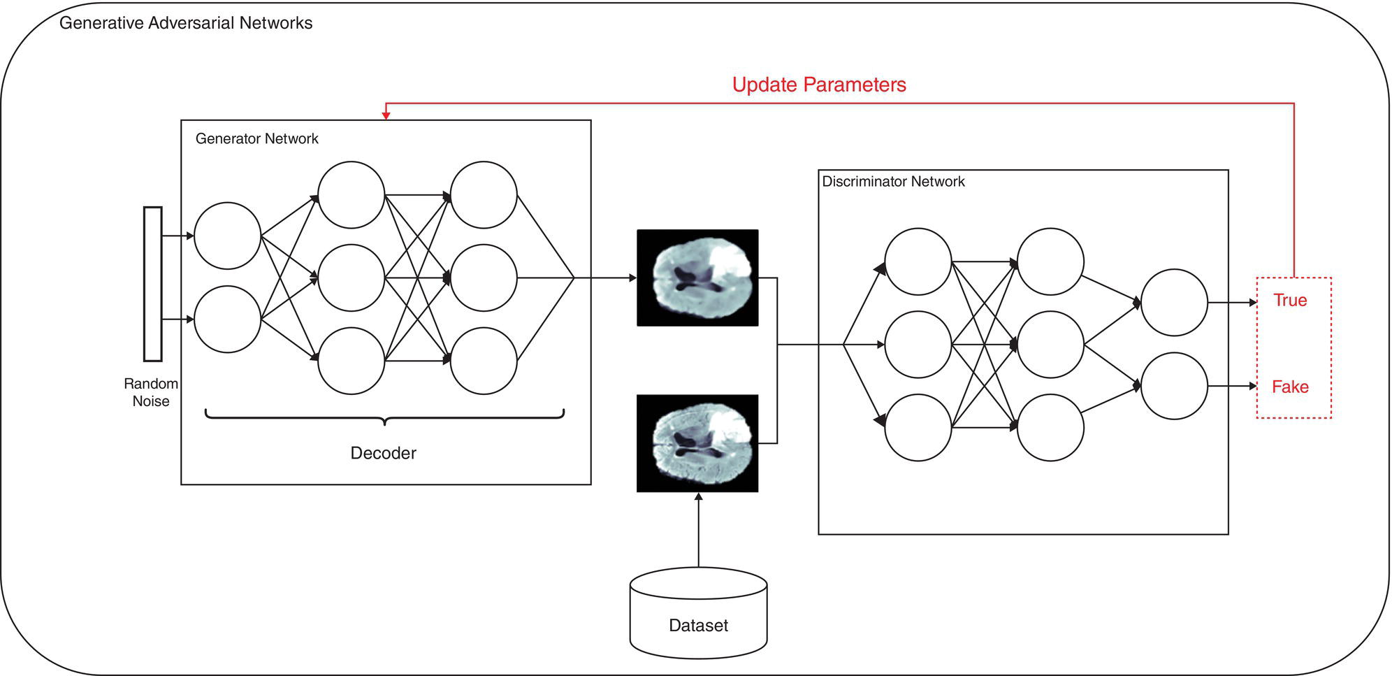 Schematic illustration of an overview of how generative adversarial networks work.