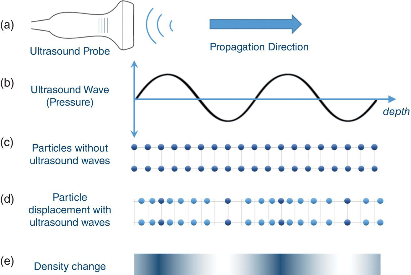 A schematic diagram contains different waveforms labeled as ultrasound probe, ultrasound wave, particles without ultrasound waves, particle displacement with ultrasound wave, and density change.