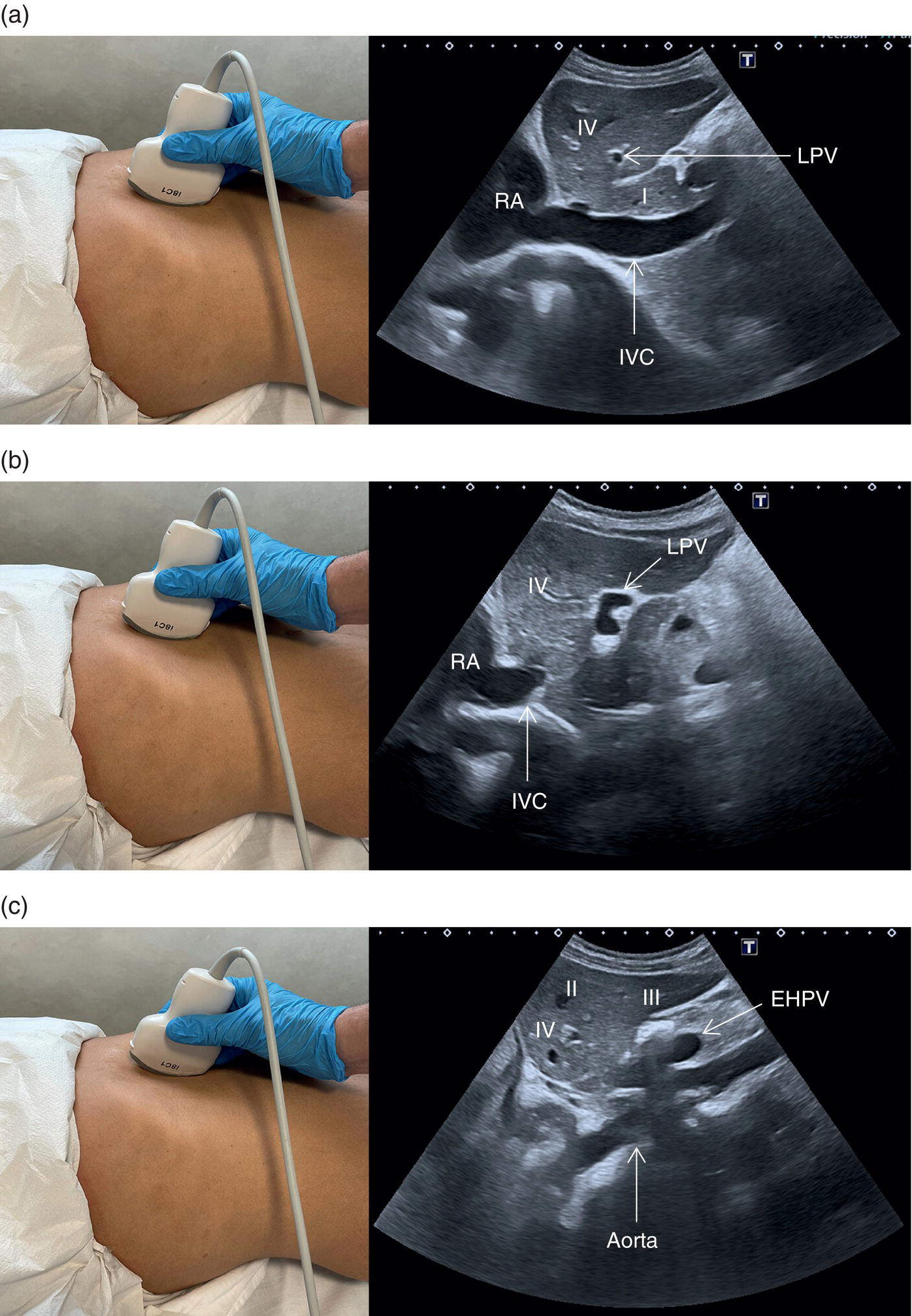 Five photographs and scanned images. The photographs depict the scanning procedure on the stomach. The scan images depict segments 5 to 8, 6, and 7 are depicted.