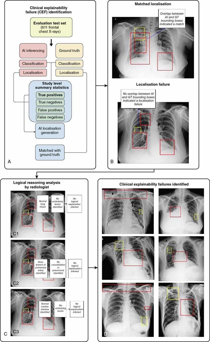 Artificial intelligence in radiology | Radiology Key