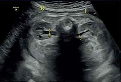 Obstetrics normogram | Radiology Key