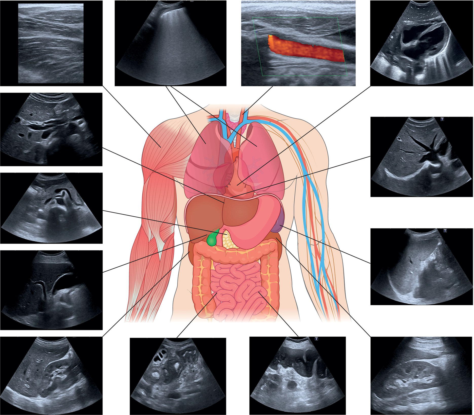 A schematic human anatomy of deeper structures and organs. It includes thirteen ultrasound elastography images for the related structures. They are labeled from the diagram.